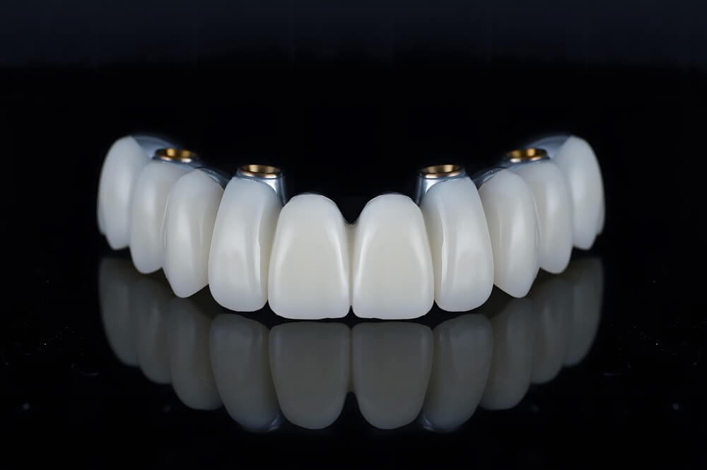 all-on-4-implants all on 4 pearly white dental implants ready to be put to use