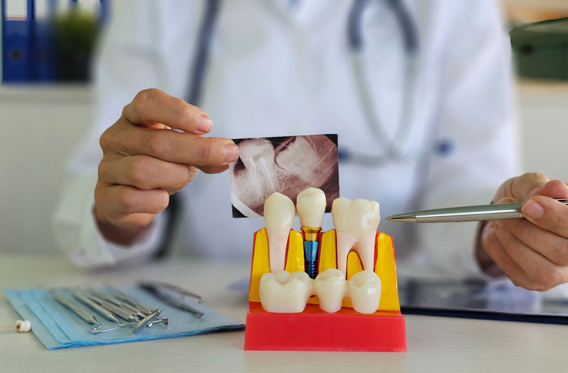 06-Dental-professional-examines-tooth-model Dental professional examines tooth model and X-ray to assess patient condition and treatment options